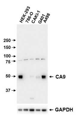 Western Blot Detection of Carbonic Anhydrase IX/CA9 in Multiple Human Cell Lysates