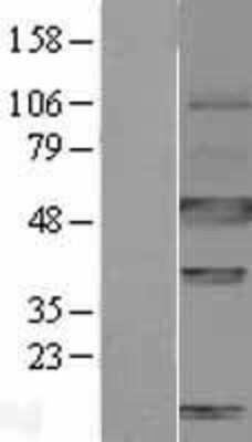 Western Blot: Carbonic Anhydrase IX/CA9 Overexpression Lysate [NBL1-08619]