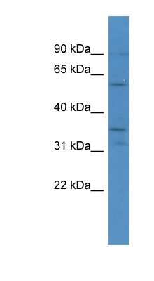 Western Blot: Carbonic Anhydrase VA/CA5A Antibody [NBP1-68889]