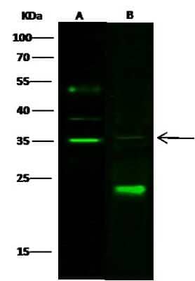 Western Blot: Carbonic Anhydrase VA/CA5A Antibody [NBP2-99341]