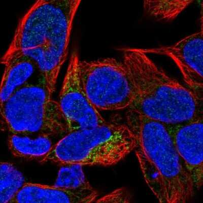 Immunocytochemistry/ Immunofluorescence: Carbonic Anhydrase VB/CA5B Antibody [NBP1-86090]