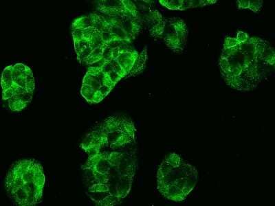 Immunocytochemistry/ Immunofluorescence: Carbonic Anhydrase VB/CA5B Antibody [NBP2-99971]