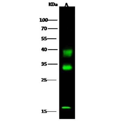 Western Blot: Carbonic Anhydrase VB/CA5B Antibody [NBP2-99972]