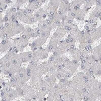 Immunohistochemistry-Paraffin: Carbonic Anhydrase VI Antibody [NBP1-87536]