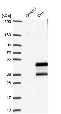 Western Blot: Carbonic Anhydrase VI Antibody [NBP1-87537]