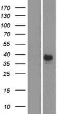 Western Blot: Carbonic Anhydrase VI Overexpression Lysate [NBP2-10966]