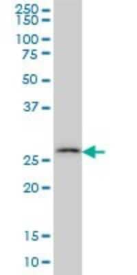 Western Blot: Carbonic Anhydrase VII/CA7 Antibody (3B7) [H00000766-M06]