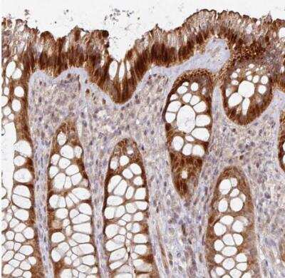 Immunohistochemistry-Paraffin: Carbonic Anhydrase VII/CA7 Antibody [NBP2-30702]