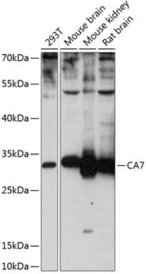 Western Blot: Carbonic Anhydrase VII/CA7 AntibodyBSA Free [NBP2-92156]