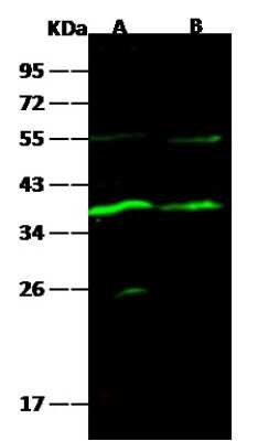 Western Blot: Carbonic Anhydrase VIII/CA8 Antibody (005) [NBP2-90710]