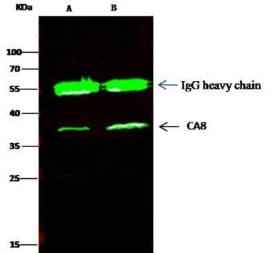 Immunoprecipitation: Carbonic Anhydrase VIII/CA8 Antibody (008) [NBP2-89517]