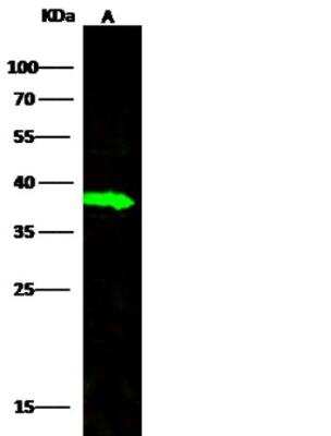 Western Blot: Carbonic Anhydrase VIII/CA8 Antibody (008) [NBP2-89517]