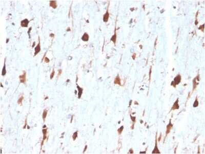 Immunohistochemistry-Paraffin: Carbonic Anhydrase VIII/CA8 Antibody (CA8/6572) [NBP3-13797]