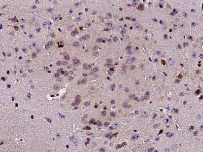 Immunohistochemistry-Paraffin: Carbonic Anhydrase VIII/CA8 Antibody [NBP2-98350]