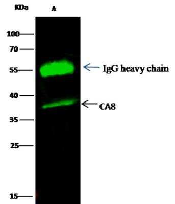 Immunoprecipitation: Carbonic Anhydrase VIII/CA8 Antibody [NBP2-98350]