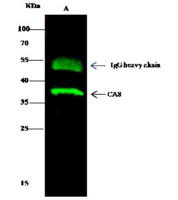 Immunoprecipitation: Carbonic Anhydrase VIII/CA8 Antibody [NBP2-99319]