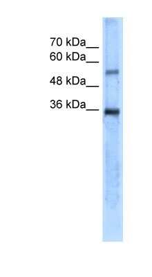 Western Blot: Carbonic Anhydrase VIII/CA8 Antibody [NBP1-54947]