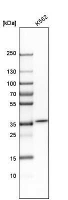 Western Blot: Carbonic Anhydrase VIII/CA8 Antibody [NBP1-86654]