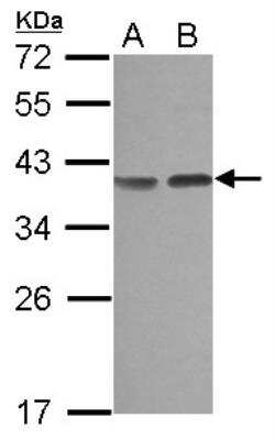 Western Blot: Carbonic Anhydrase VIII/CA8 Antibody [NBP2-15657]