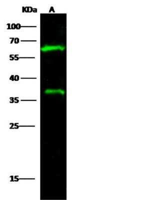 Western Blot: Carbonic Anhydrase VIII/CA8 Antibody [NBP2-98350]