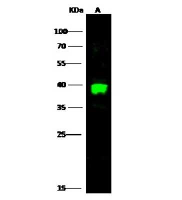 Western Blot: Carbonic Anhydrase VIII/CA8 Antibody [NBP2-99319]