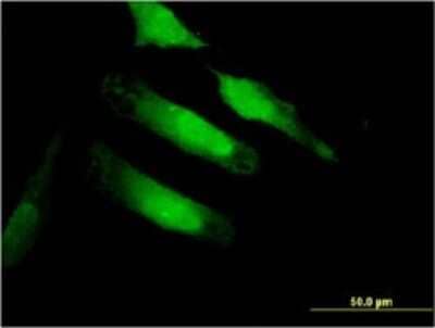 Immunocytochemistry/ Immunofluorescence: Carbonic Anhydrase X/CA10 Antibody (1A10) [H00056934-M01]