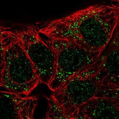 Immunocytochemistry/ Immunofluorescence: Carbonic Anhydrase X/CA10 Antibody [NBP2-55638]