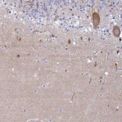 Immunohistochemistry: Carbonic Anhydrase X/CA10 Antibody [NBP2-31586]
