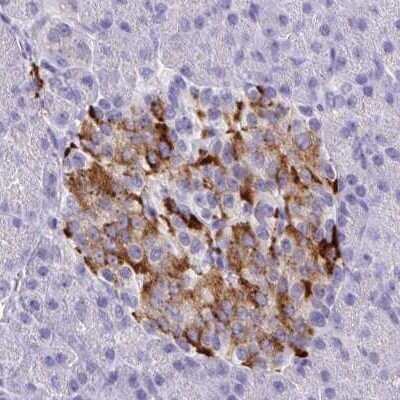 Immunohistochemistry: Carbonic Anhydrase X/CA10 Antibody [NBP2-31586]