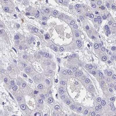 Immunohistochemistry: Carbonic Anhydrase X/CA10 Antibody [NBP2-31586]