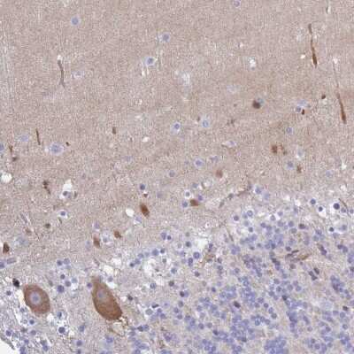 Immunohistochemistry-Paraffin: Carbonic Anhydrase X/CA10 Antibody [NBP2-31586]