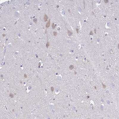 Immunohistochemistry-Paraffin: Carbonic Anhydrase X/CA10 Antibody [NBP2-31586]