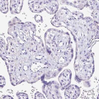 Immunohistochemistry-Paraffin: Carbonic Anhydrase X/CA10 Antibody [NBP2-31586]