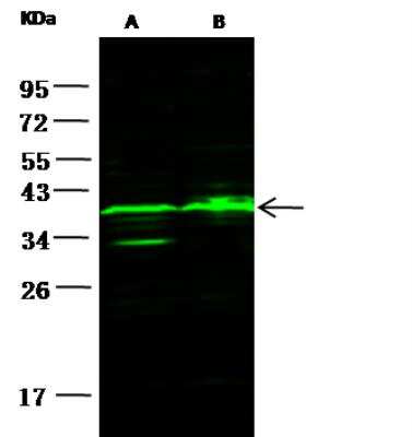 Western Blot: Carbonic Anhydrase X/CA10 Antibody [NBP2-98120]