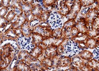Immunohistochemistry-Paraffin: Carbonic Anhydrase XII/CA12 Antibody (012) [NBP2-90352]