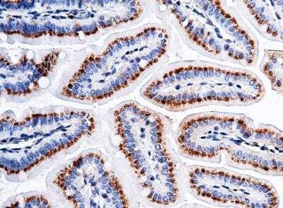 Immunohistochemistry-Paraffin: Carbonic Anhydrase XII/CA12 Antibody (012) [NBP2-90352]