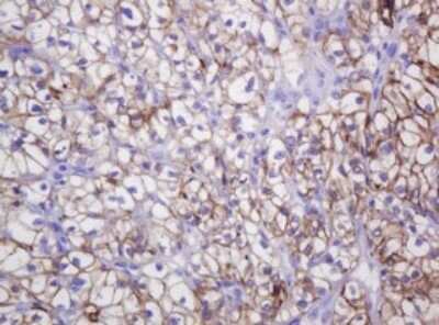 Immunohistochemistry: Carbonic Anhydrase XII/CA12 Antibody (OTI2C6) [NBP2-46042]