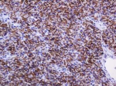 Immunohistochemistry: Carbonic Anhydrase XII/CA12 Antibody (OTI2C6) [NBP2-46042]