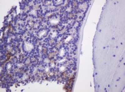 Immunohistochemistry: Carbonic Anhydrase XII/CA12 Antibody (OTI2C6) [NBP2-46042]