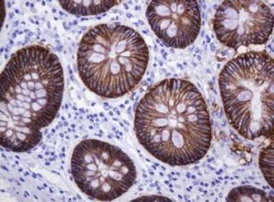 Immunohistochemistry: Carbonic Anhydrase XII/CA12 Antibody (OTI2C6) [NBP2-46042]