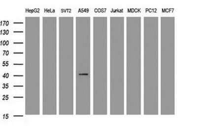 Western Blot: Carbonic Anhydrase XII/CA12 Antibody (OTI2C6) [NBP2-46042]