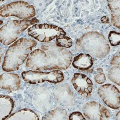 Immunohistochemistry-Paraffin: Carbonic Anhydrase XII/CA12 Antibody (CL0278) [NBP2-52901]