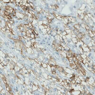 Immunohistochemistry-Paraffin: Carbonic Anhydrase XII/CA12 Antibody (CL0278) [NBP2-52901]