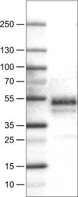 Western Blot: Carbonic Anhydrase XII/CA12 Antibody (CL0278) [NBP2-52901]