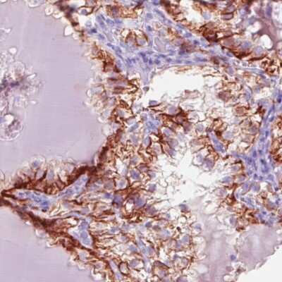 Immunohistochemistry-Paraffin: Carbonic Anhydrase XII/CA12 Antibody (CL0280) [NBP2-52902]