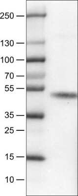 Western Blot: Carbonic Anhydrase XII/CA12 Antibody (CL0280) [NBP2-52902]