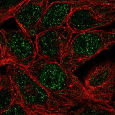 Immunocytochemistry/ Immunofluorescence: Carbonic Anhydrase XII/CA12 Antibody [NBP1-81668]