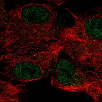 Immunocytochemistry/ Immunofluorescence: Carbonic Anhydrase XII/CA12 Antibody [NBP2-57791]