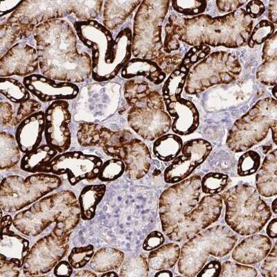 Immunohistochemistry-Paraffin: Carbonic Anhydrase XII/CA12 Antibody [NBP1-81668]