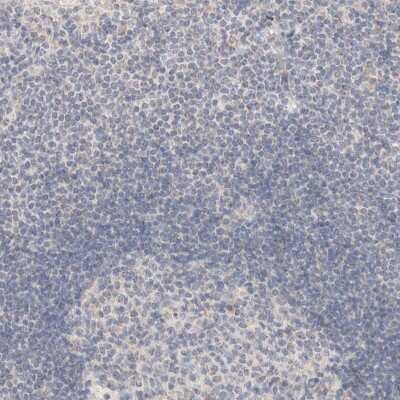Immunohistochemistry-Paraffin: Carbonic Anhydrase XIII/CA13 Antibody [NBP1-86606]